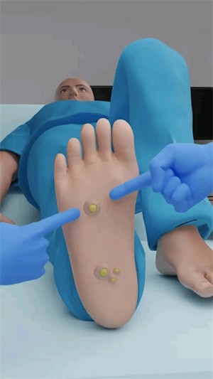 修脚解压模拟器